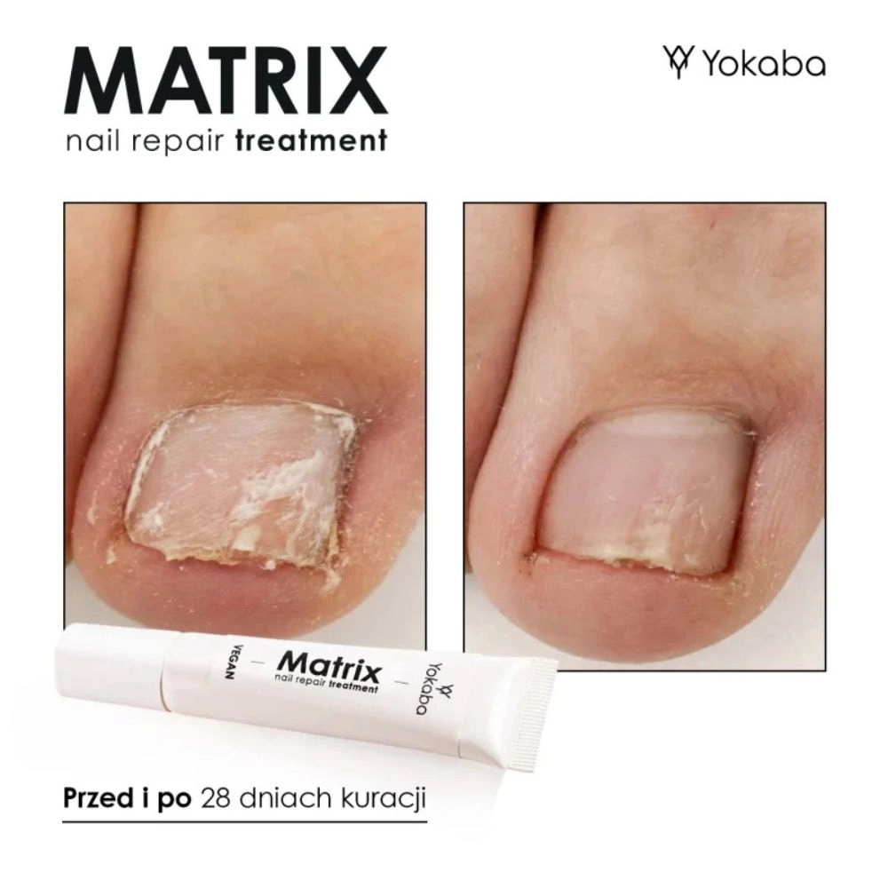 Serum regeneracyjne do paznokci Matrix Nail Repair Treatment | Yokaba