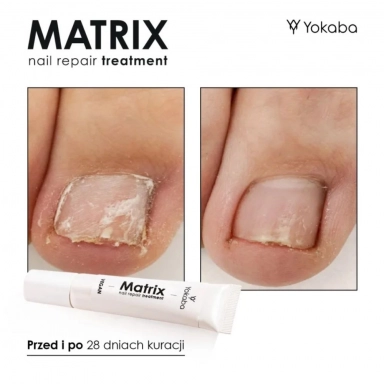 Serum regeneracyjne do paznokci Matrix Nail Repair Treatment | Yokaba