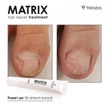 Serum regeneracyjne do paznokci Matrix Nail Repair Treatment | Yokaba
